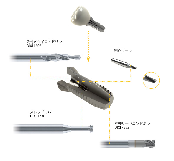 インプラントへの適用例